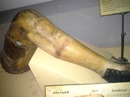 Civil War Artificial Leg.jpg